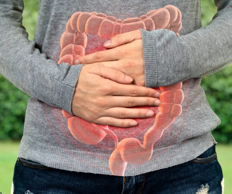 Candidiase Intestinal